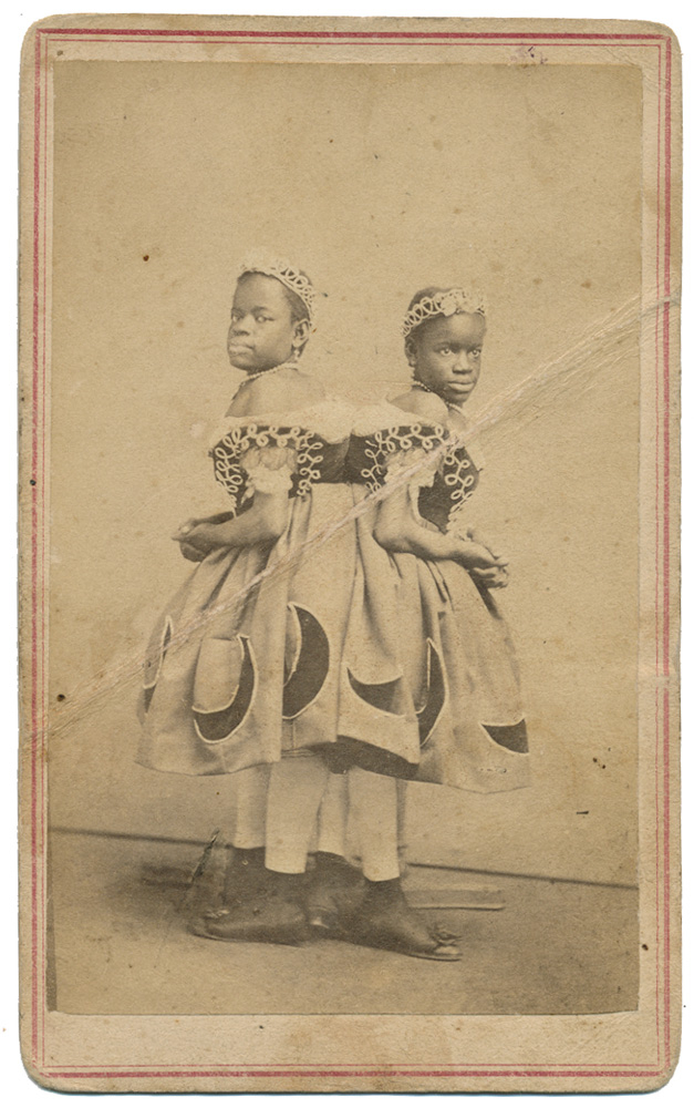 CDV OF “THE CAROLINA TWINS”